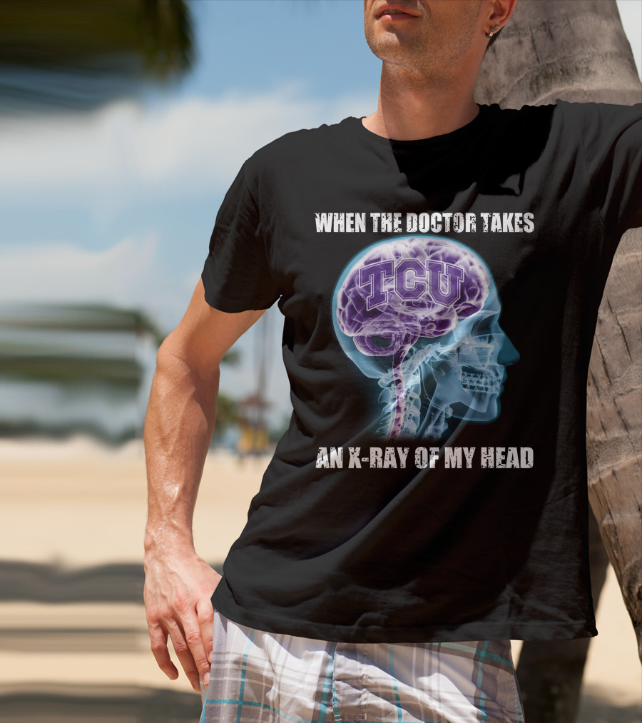 TCU Horned Frogs When The Doctor Takes An X-ray Of My Head T-Shirt