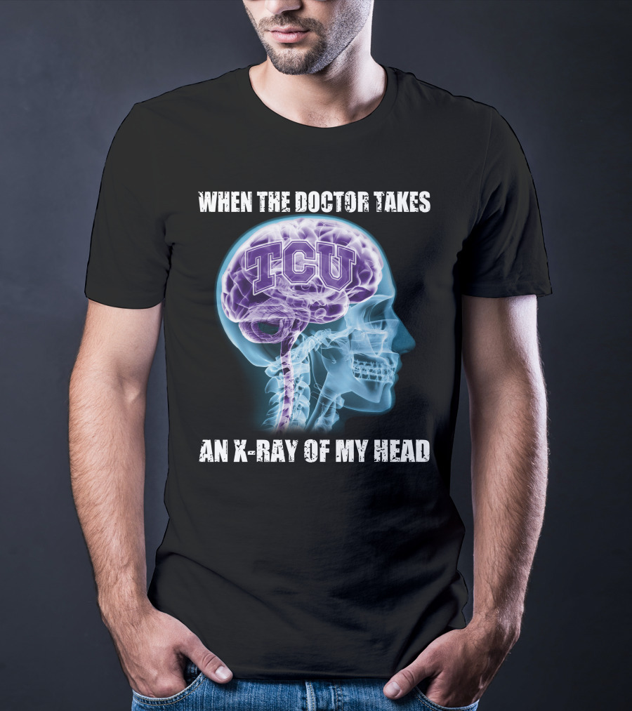 TCU Horned Frogs When The Doctor Takes An X-ray Of My Head T-Shirt