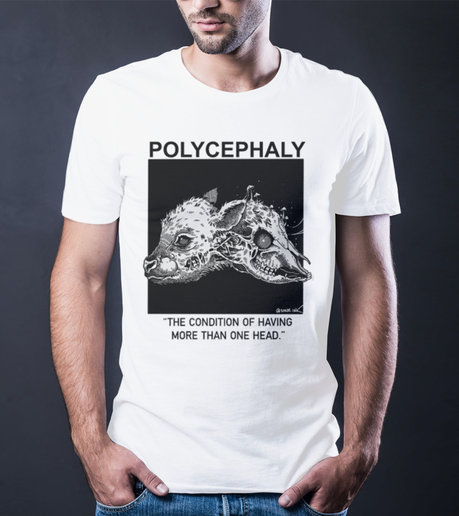 Polycephaly The Condition Of Having More Than One Head T-Shirt