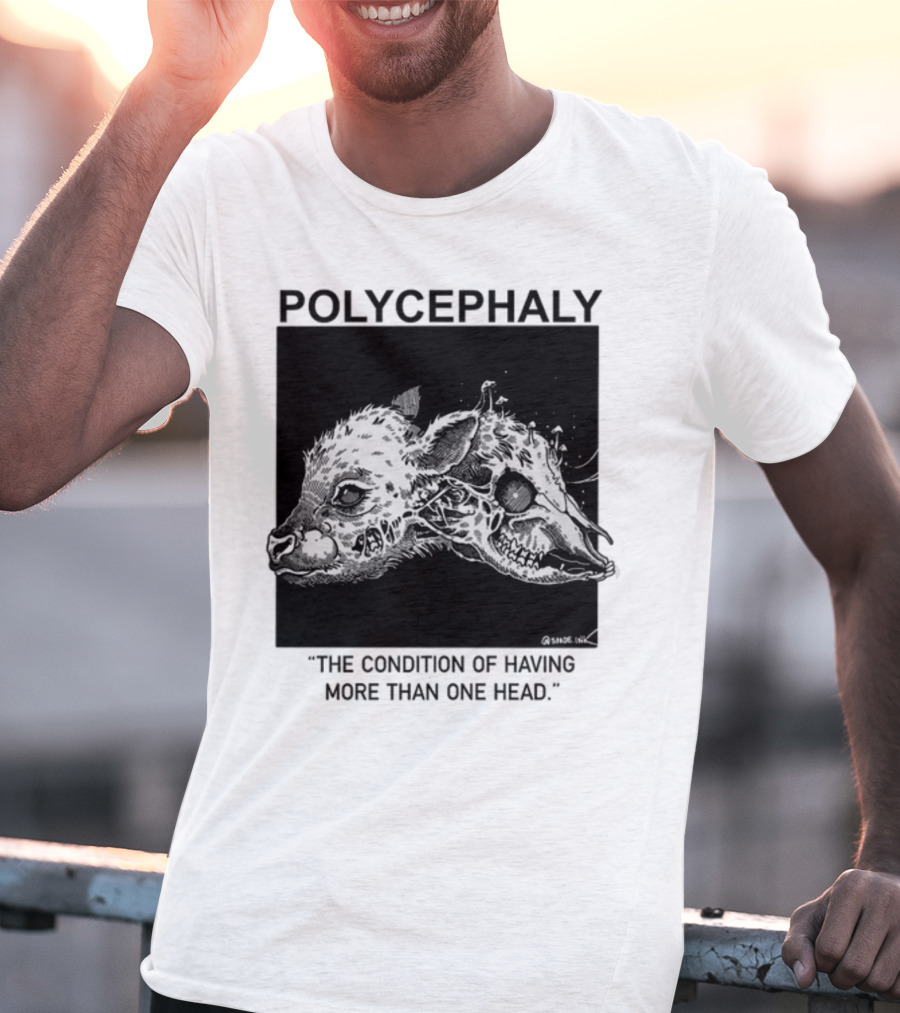 Polycephaly The Condition Of Having More Than One Head T-Shirt