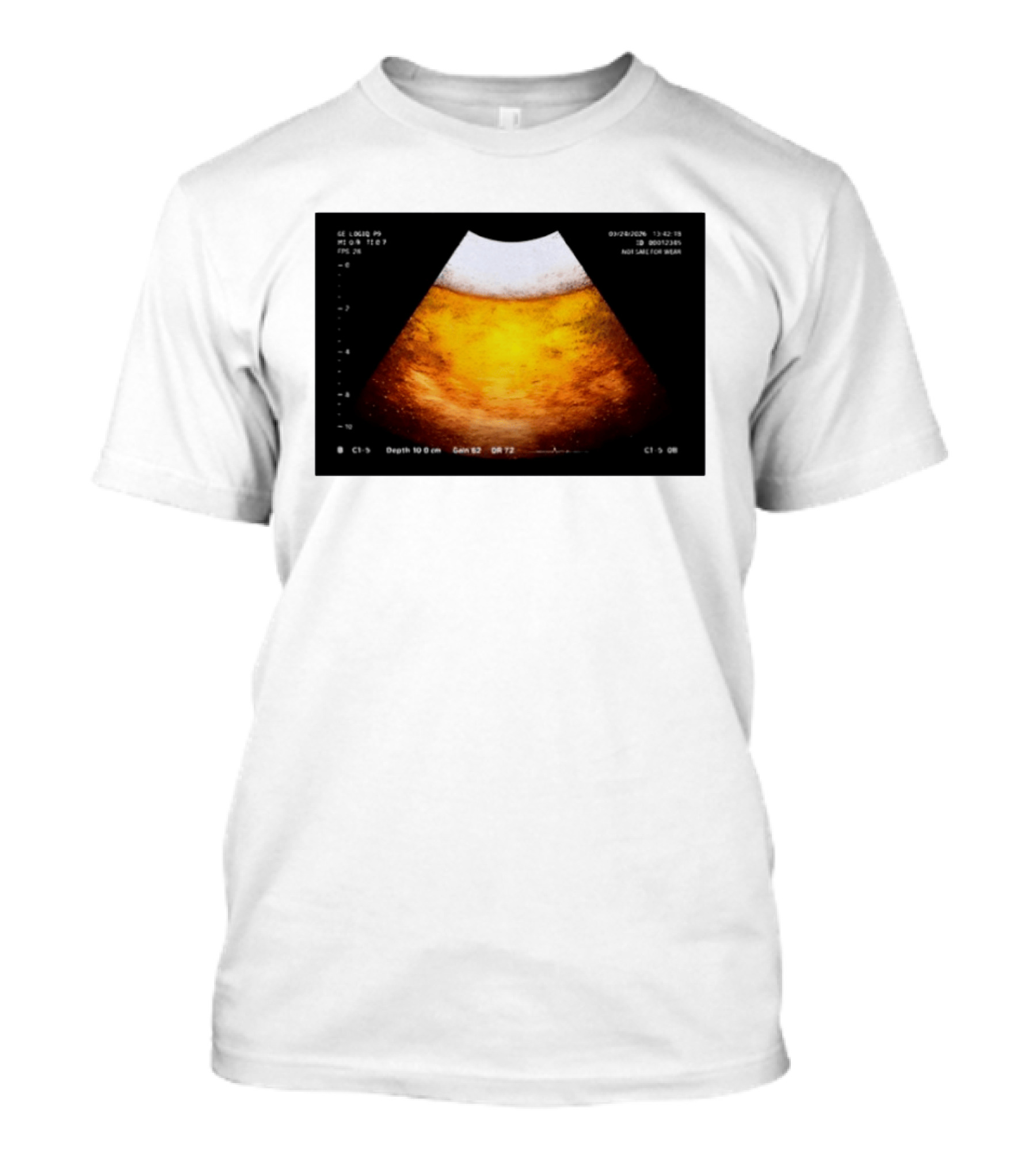 Beer Ultrasound Image Not Safe For Liver T-Shirt