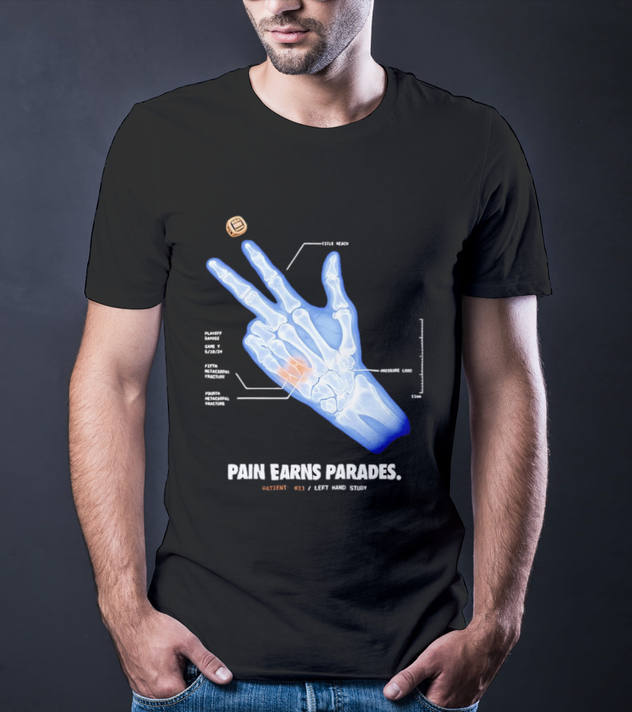 Pain Earns Parades X Ray Left Hand Study Detailed Anatomy T-Shirt