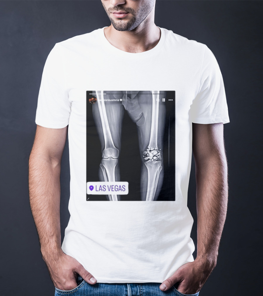 Conor McGregor X Ray Broken Knee Las Vegas T-Shirt