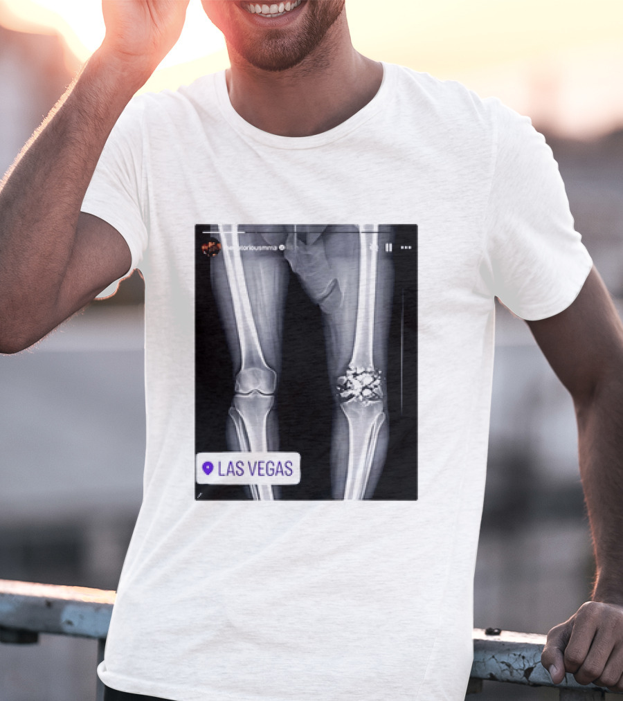 Conor McGregor X Ray Broken Knee Las Vegas T-Shirt